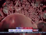 《直播全球》 20180125
