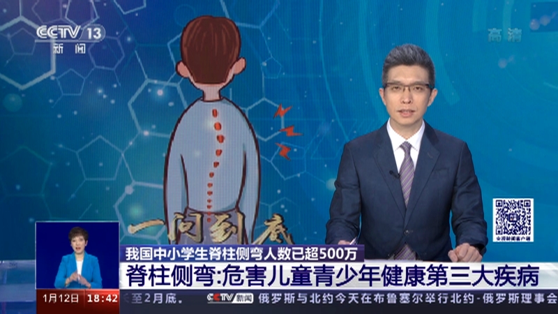 [共同关注]我国中小学生脊柱侧弯人数已超500万 脊柱侧弯：危害儿童青少年健康第三大疾病_CCTV节目官网-CCTV-13_央视网(cctv.com)