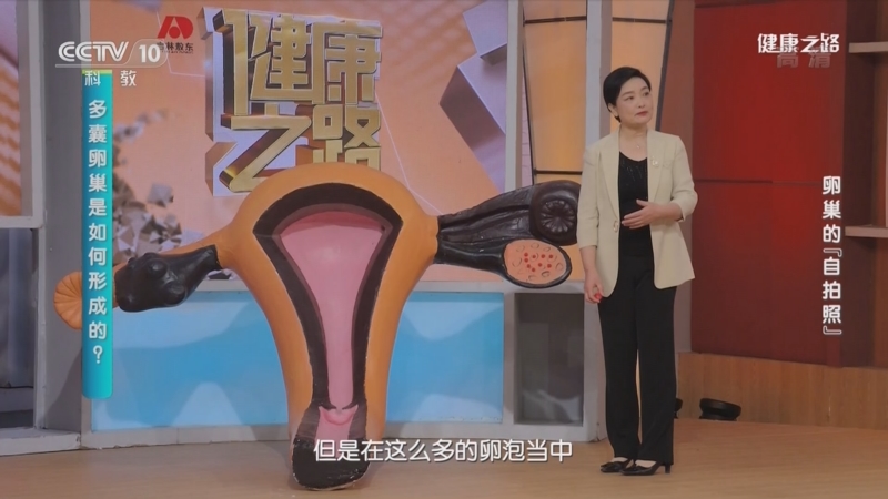 [健康之路]卵巢的“自拍照” 警惕“百香果”——多囊卵巢_CCTV节目官网-CCTV-10_央视网(cctv.com)