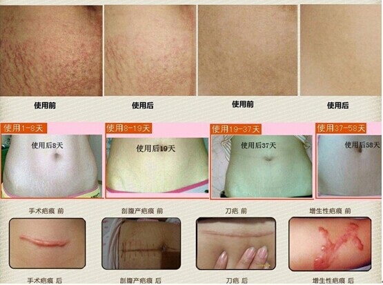 杨幂产女不惧妊娠纹 明星妈妈圈<em>流行美</em>孕宝_粤