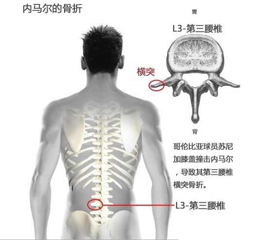 图解