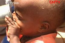 Starved Somali children seeking help 