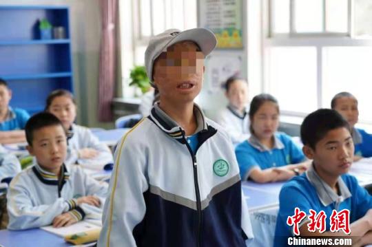 “奇迹男孩”10年“爱心之旅”：感恩接纳 感谢帮助