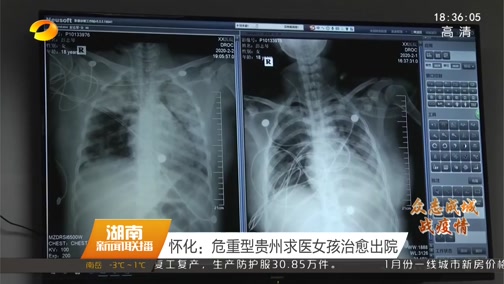 [湖南新闻联播]怀化：危重型贵州求医女孩治愈出院