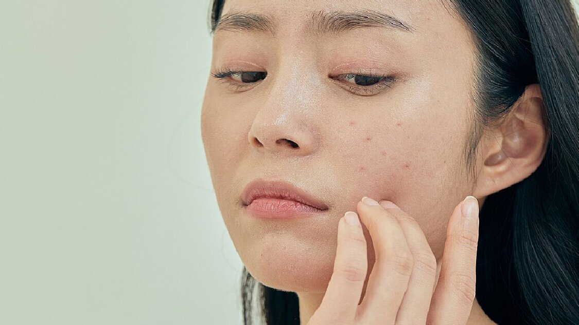 科学养护 善待皮肤