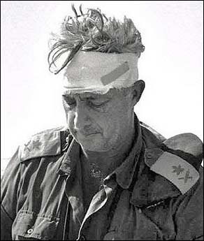 (上图:1973年沙龙在中东战争中头部受伤.这是当时他头缠着绷带的照片.