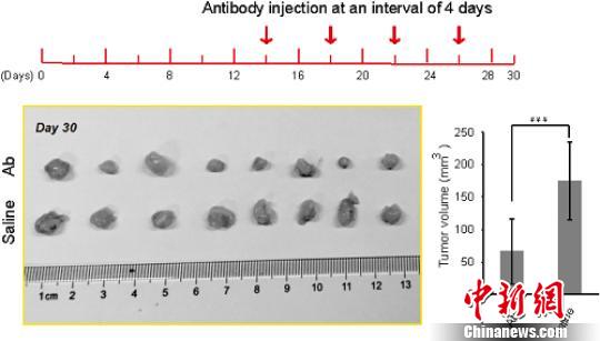 中国科研人员发现新型肺癌标志物