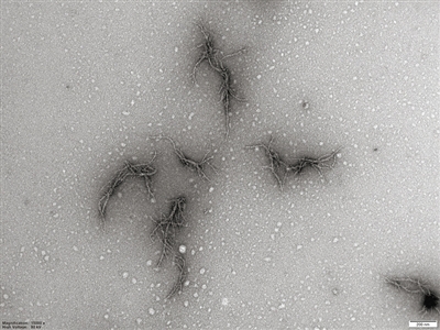 这是使用电子显微镜观察到的来自新冠病毒刺突蛋白的淀粉样蛋白图片。当刺突蛋白与试管中的中性粒细胞弹性蛋白酶混合时，会产生分支蛋白纤维，这可能会导致新冠肺炎患者的凝血功能障碍。 图片来源：《美国化学学会杂志》