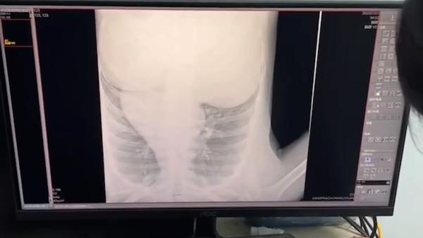 Bet365 - Online Sports Betting如何正确挑选滑雪板