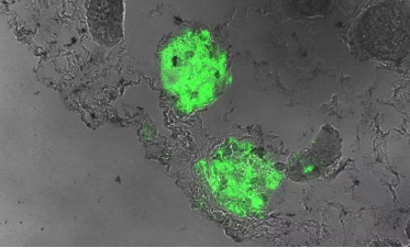 图1：绿色荧光显示整合进入肾小球的SOX9⁺肾前体细胞（临床前研究数据）